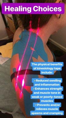 Benefits of laser and kinesiotaping.