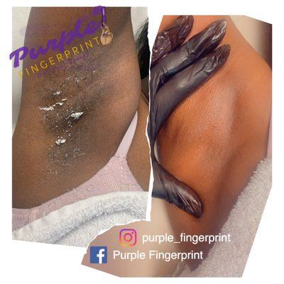 Underarm Wax