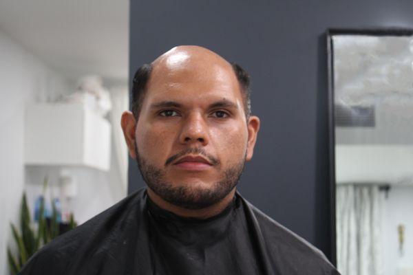 Before: Client 6