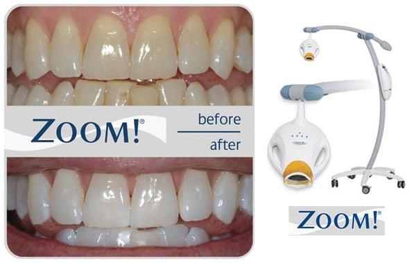 Zoom Whitening