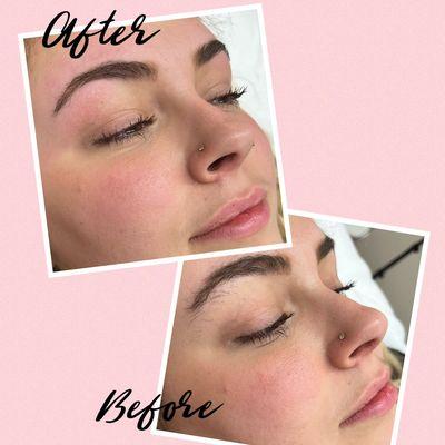 Before and After Brow Sugaring