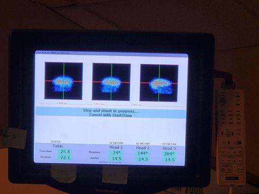 SPECT Scan