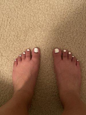 Bad pedicure