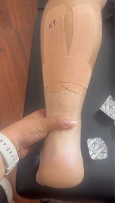 K tape for gastroc strain