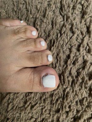 Horrible Shellac Pedicure