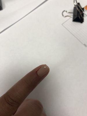 This is my nail that was cut with the tools that may not be sanitized after use.