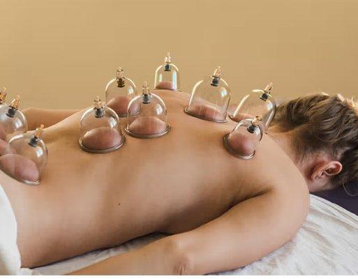 Cupping therapy