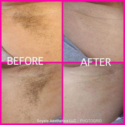 Another satified client. Whose ready to be smooth?