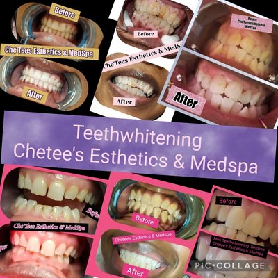 Che'Tees Esthetics & MedSpa