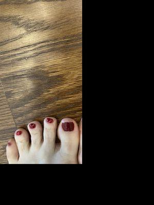 The nick on the right big toe. Nailpolish on skin on top of toes.