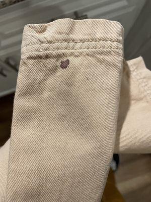 Blood on ankle of pants