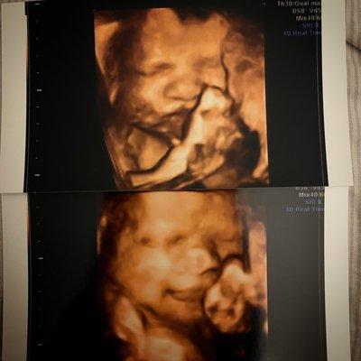 Little Toes & Fingers Ultrasound