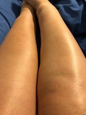 My legs right after I was able to rinse.