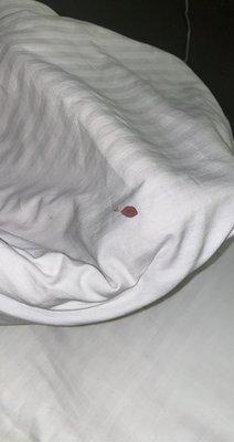 Blood (not ours) in the sheets...