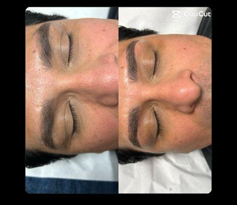 before and after brow wax