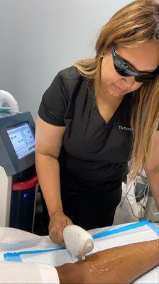 Laser Hair Removal on lower legs