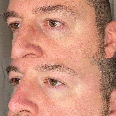 Mens anti aging facial and brow waxing