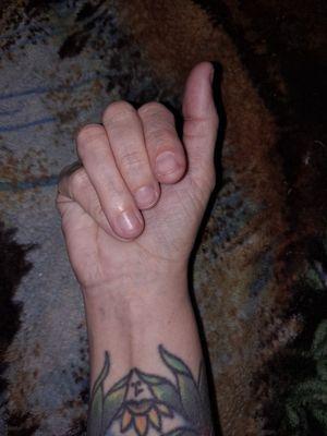 Pinky folds over palm, index finger doesn't bend