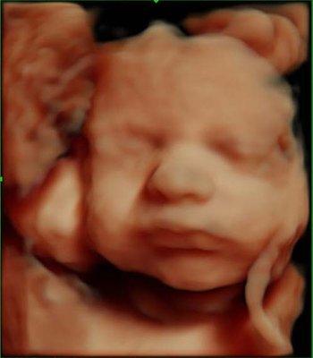 3D/4D/HD Live Ultrasound