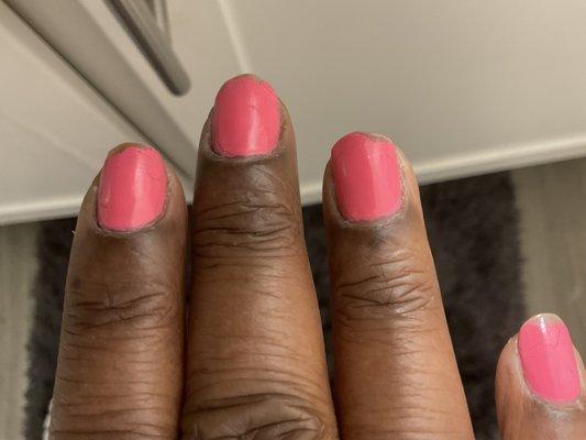 The next day after a manicure at Shark Nail Bar. They didn't even bother looking at my nail and acted like I was begging for free service.