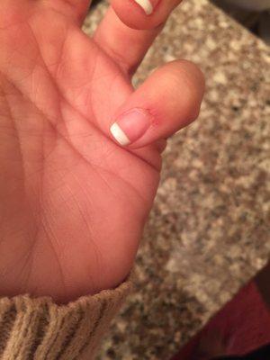 What they did to my nail. It hurts very bad and I paid 40$ for this