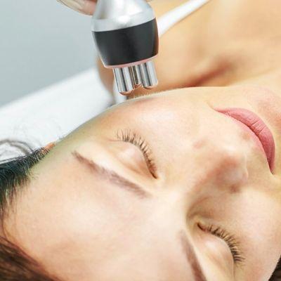 Radio frequency facial