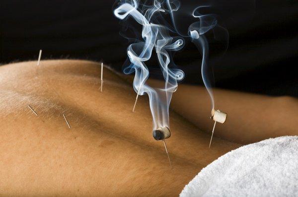 Acupuncture & Chinese Herbs