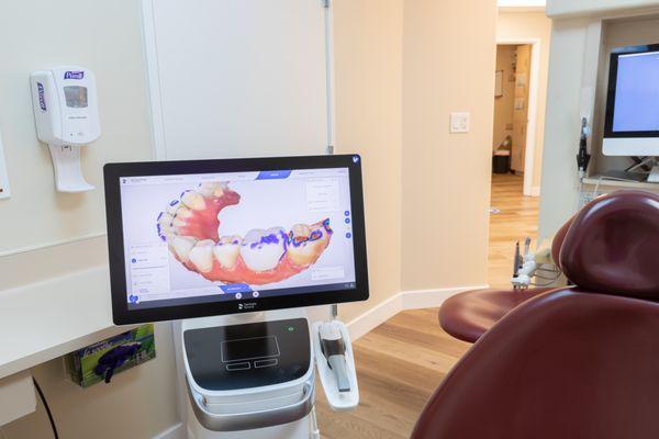 CEREC scanner for same day dental crowns at Sunnyvale dentist Derek H. Tang, DDS