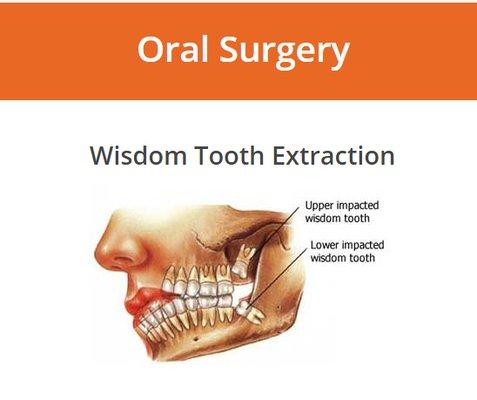 Oral Surgery in Orange County