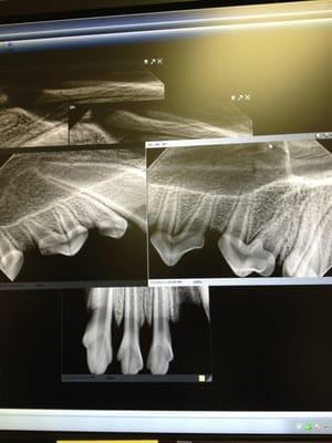 Our digital dental radiograph machine gives great information about which teeth are healthy.