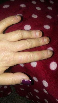 "Stear clear of this nail salon!" I lost my nails due to poor application of acrylic nail,s" Nail fungus a week and half later