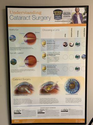 Cataract Info