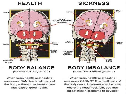 Atlas-Axis must be in alignment for the free expression of nerve expression through the brain stem. Arthro-stim does this without pain