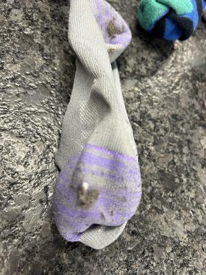 Pic of a sock that collected a ton of hair in big knots.