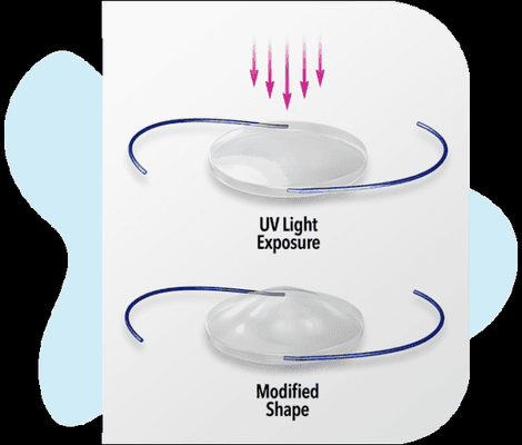 LIGHT ADJUSTABLE LENS - one of only a handful of elite practices offering this vision-customizing technology