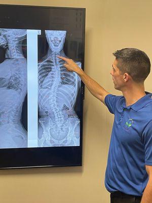 Dr. Cotey going over X-Rays. X-rays are extremely important to determine exactly what is going on with your spinal alignment!