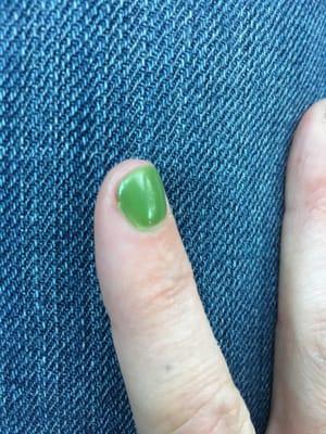 Sides are lifting. This is the nail that was cut back too short. I keep my nails long so I was taken back by the length.