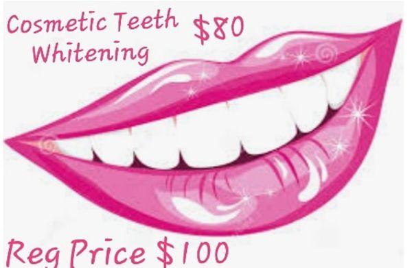 Teeth Whitening SPECIAL ! 60 minute session for ONLY $80 Regular Price $100