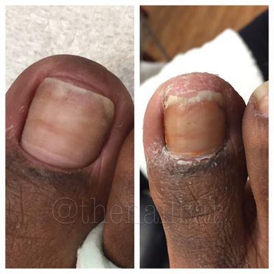 If one or more of your toe nails look like this...IT'S NOT DRY SKIN!! Schedule your next pedicure with me CALL/TEXT 407.486.2407