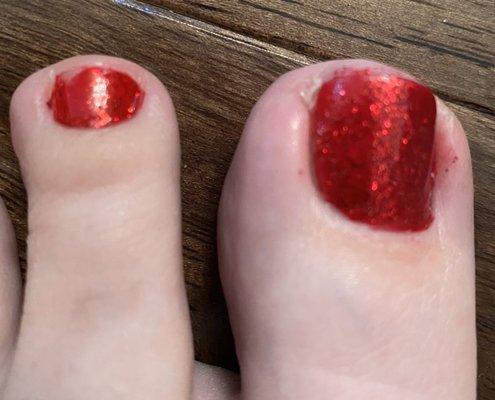 Pedicure. Polish rubbed of by tech. Polish all over cuticles.