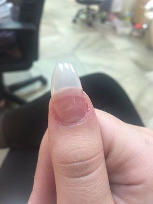 My nail is suppose to be slightly confined . Neither of the sides are equal .!! This is shaped so shitty