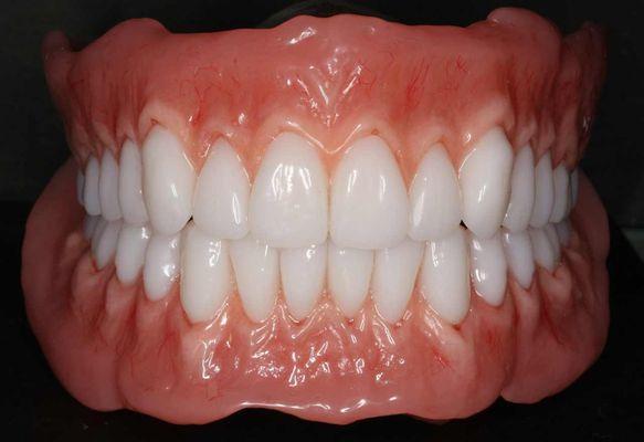 HIGH END 
BPS DENTURES