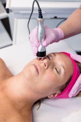 RF SKin Tightening - Tightens and Lifts sagging and laxed skin.  Perfect for aging skin and loss of volume from weight loss.