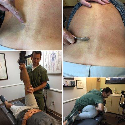 Post surgery back pain treated with IASTM, stretching and manual adjustment. Let us find the best treatment plan to suit your needs.