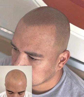 Southeast SMP Scalp Micropigmentation Center