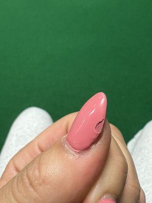 Chipped nail