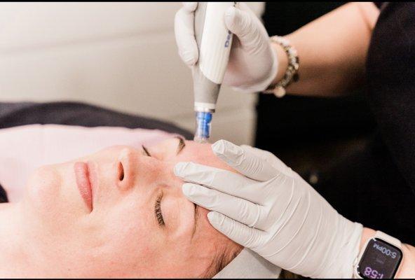 Advanced microneedling in a relaxed environment. Great for all skin types and concerns.