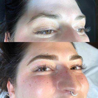 Microblading and Freckles