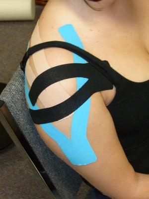 Kinesio Taping for pain due to rotator cuff problems.