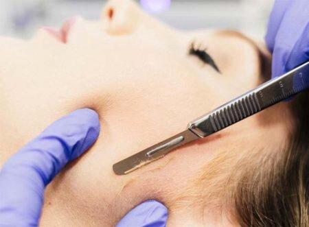 Dermaplaning Treatment